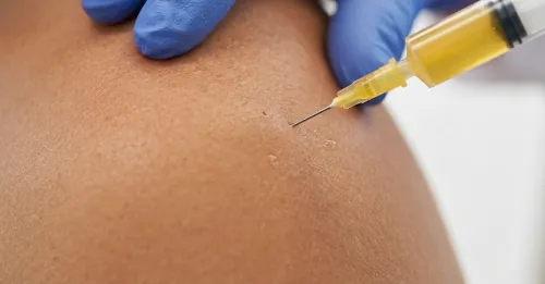 Prolotherapy